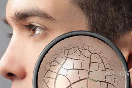 為什么秋季皮膚容易起皮? 為什么秋季皮膚容易起皮?