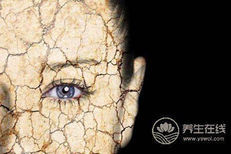 為什么秋季皮膚容易起皮? 為什么秋季皮膚容易起皮?