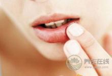 預防秋季爛嘴角的方法有哪些
