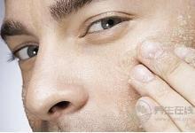 秋燥傷皮膚，4個妙招杜絕干癢上身