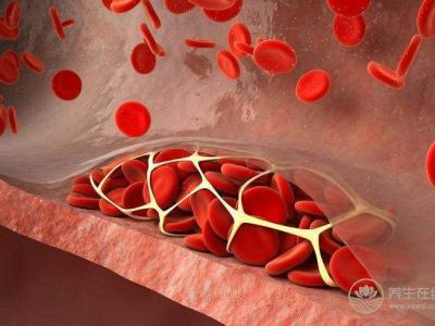 秋季如何預(yù)防血栓形成