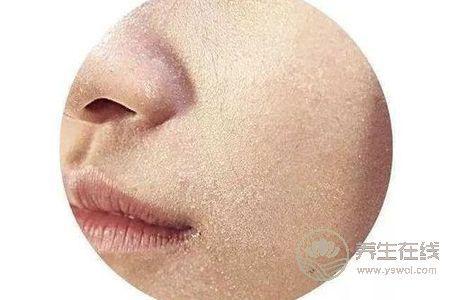 秋季皮膚為什么會(huì)過(guò)敏?秋季皮膚過(guò)敏有什么癥狀?