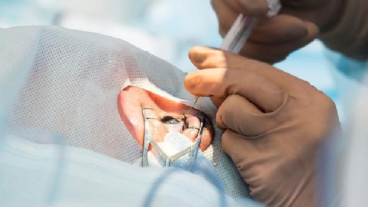 春季鼻炎患者要注意什么事項(xiàng) 鼻炎患者需格外注意這些事項(xiàng)