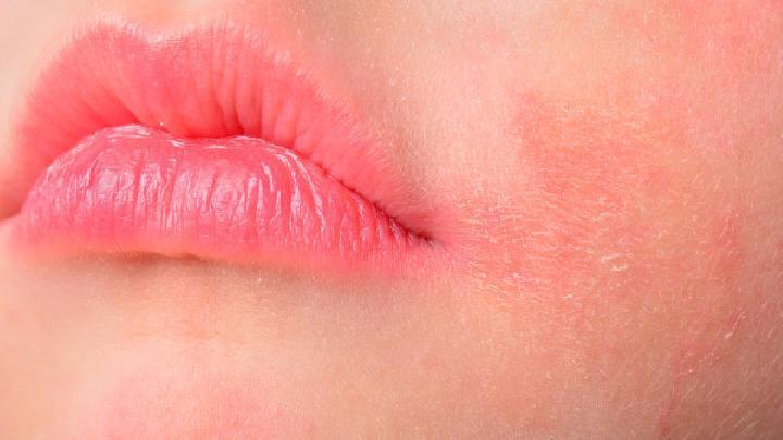 教你如何花粉過敏 預防花粉過敏的小常識分享