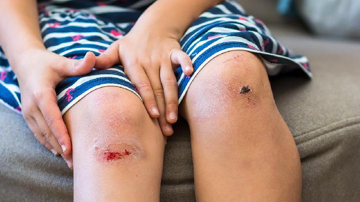 冬季進補切勿走入誤區 冬季進補兒童體弱不宜多食補