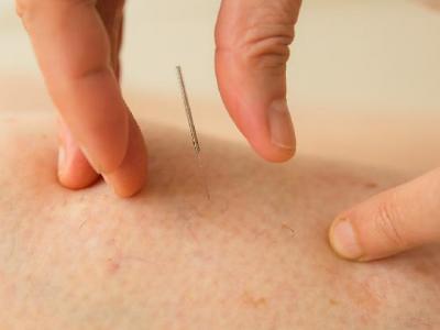 花粉過(guò)敏應(yīng)該如何治療 6方法可有效治療花粉過(guò)敏