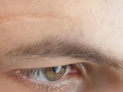 預防春季過敏的方法有哪些 春季過敏存在5大原因