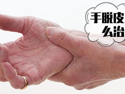 冬天手上皮膚發黑？5種原因要了解