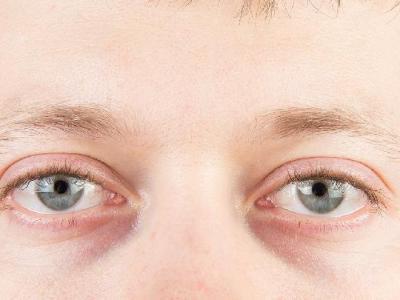 天冷護眼3方法 保護眼睛義不容辭