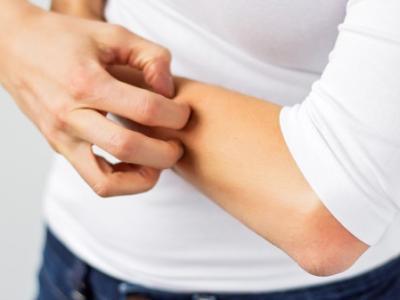 冬天皮膚瘙癢是血燥？ 需要內外調理