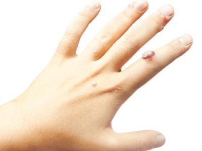 夏季怎么保養皮膚？夏天保護皮膚的方法有什么