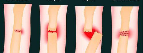 非手術(shù)方法 防治致盲眼病