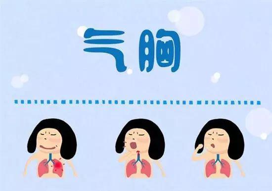 20個(gè)生活中的急救常識(shí) 