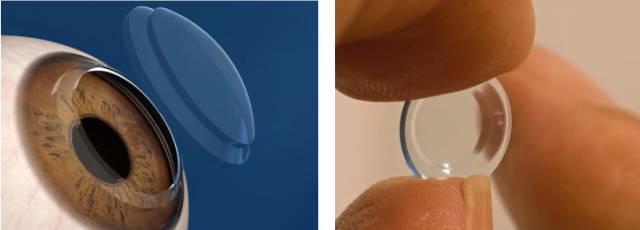 不想讓孩子戴眼鏡，怎么辦？