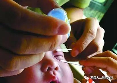 頻繁眨眼，小心是眼病信號