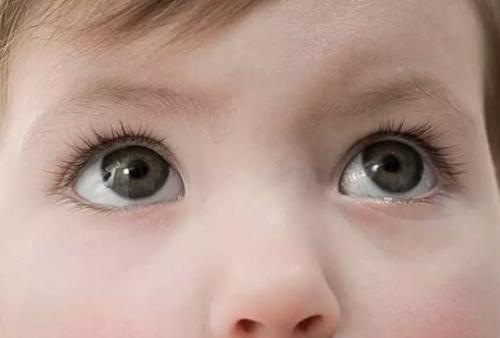 干眼癥是眼病嗎？可以治療嗎？