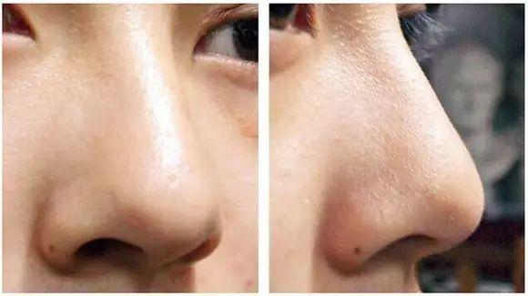 20個(gè)生活中的急救常識(shí) 