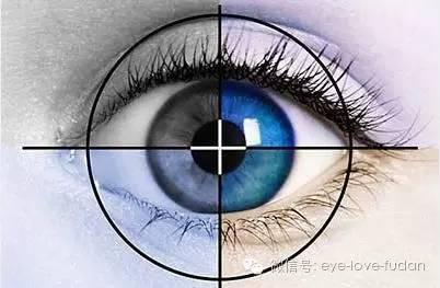 散光戴隱形眼鏡有用嗎? 散光戴隱形眼鏡有用嗎?