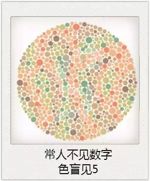 與視力相關的一些眼疾