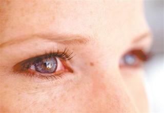 眼睛干癢怎么辦?