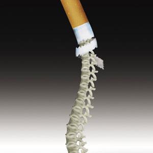 吸煙竟會(huì)引起弱視？