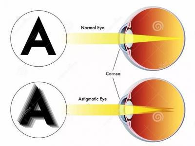 和你談談關于結膜炎的那些事