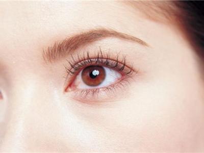 激光近視手術后遺癥