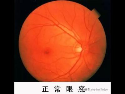 什么度數一直增加？戴鏡度數加深的五大原因！