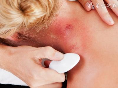 肩周炎中醫推拿治療方法