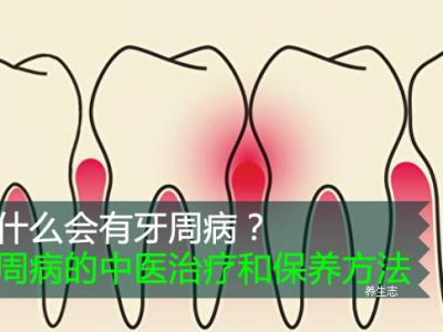 怎么會有牙周病？牙周病的中藥治療和維護保養方式