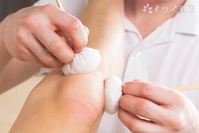 水腫按摩哪些穴位可消腫