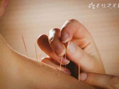 針灸后身體會虛嗎