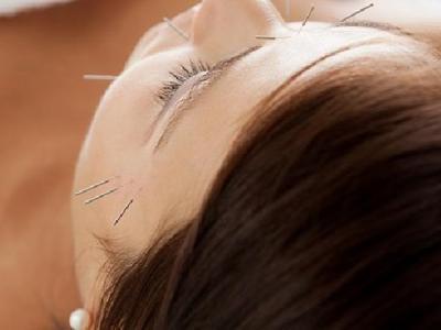 男性陽痿的針灸療法是什么? 5種男性陽痿的中醫針灸治療方法