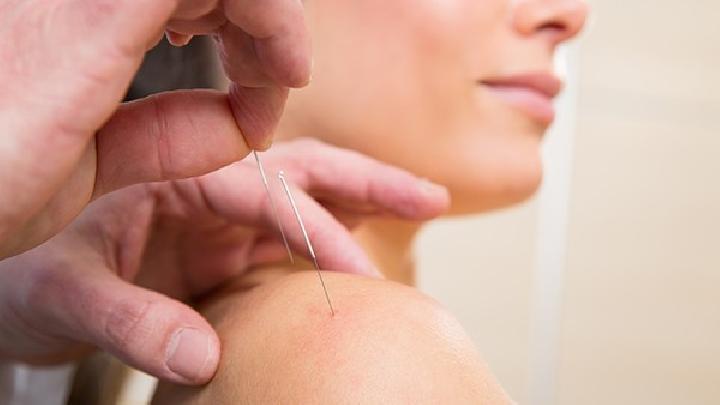 中醫(yī)針灸怎么治療麥粒腫 日常麥粒腫的4個護(hù)理方法