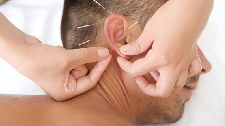 帶狀皰疹患者怎么施行針灸療法 中醫針灸治療帶狀皰疹的方法介紹