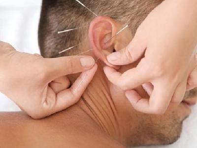 帶狀皰疹患者怎么施行針灸療法 中醫(yī)針灸治療帶狀皰疹的方法介紹