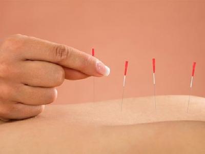 中醫針灸真的能治好近視眼嗎? 中醫針灸治療近視眼的注意事項