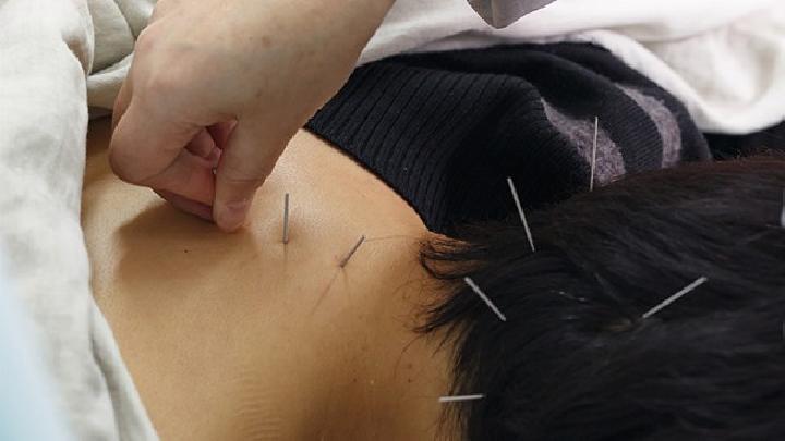 日常生活中應該如何診斷色盲 中醫針灸可以有效治療色盲