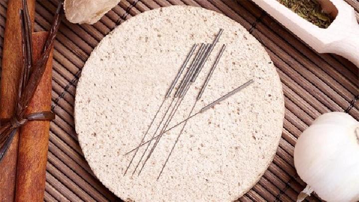 肌肉萎縮針灸治療方法是什么 中醫針灸治療肌肉萎縮的兩種方法