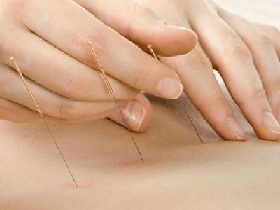 中醫針灸治療痛經有效嗎 8個方法也能緩解女性痛經