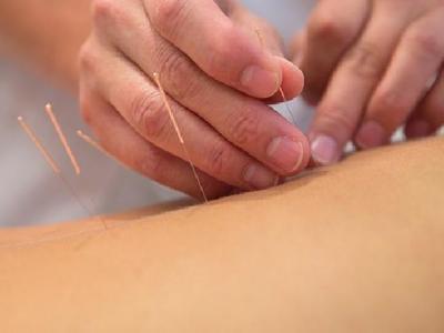 腦出血后障礙怎么治療效果最好 中醫(yī)針灸穴位可治療腦出血后障礙