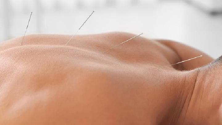 得了急性乳腺炎怎樣針灸治療 女性急性乳腺炎有什么癥狀表現(xiàn)