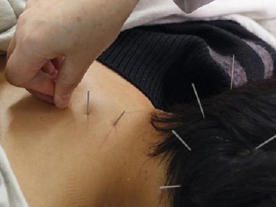 中醫針灸治療耳鳴癥狀有效嗎 中醫治療耳鳴所用的針灸方法解讀