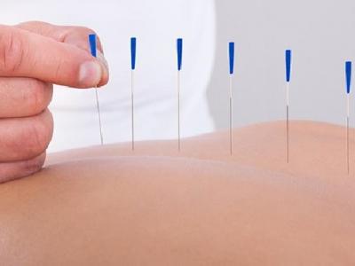 發現中風后如何選擇就醫? 中醫針灸對治療中風的作用介紹