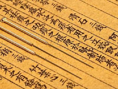 中醫針灸能治療痛經嗎 中醫針灸治療痛經的4個方法