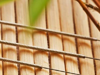 中醫針灸治蕁麻疹需要注意些什么 中醫針灸治蕁麻疹有三大止癢要點