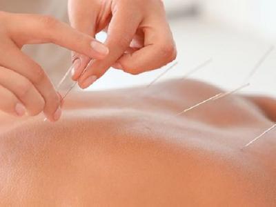 帶狀皰疹后遺神經痛怎么治療好 中藥聯合針灸治療帶狀皰疹后遺神經痛