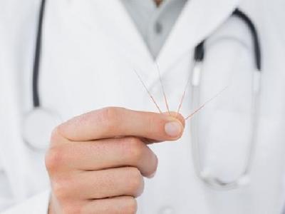 女性痛經(jīng)怎么快速解決？中醫(yī)針灸扎穴位可快速緩解痛經(jīng)癥狀