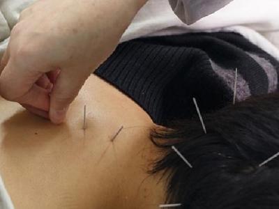 4類人群好發酒渣鼻 中醫兩大方法可治療酒渣鼻