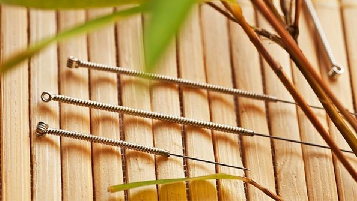 扎馬尾辮是導致斑禿的兇手 中醫針灸治療斑禿有絕招